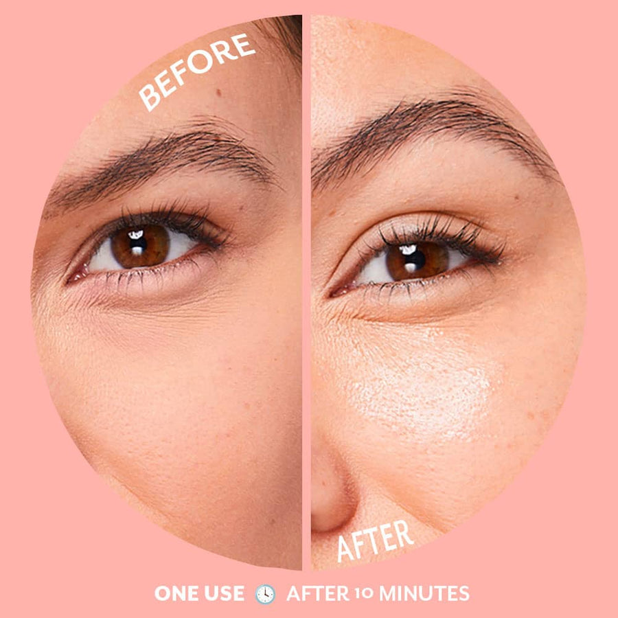 Serve Chilled Champagne Bubbly Eye Gel Pack
